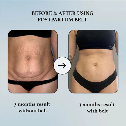 Korso™ 3-in-1 Postpartum Recovery Belt